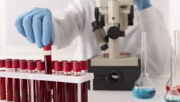coronavirus-blood-samples-arrangement-lab