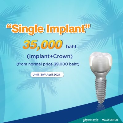 promotion dental implants