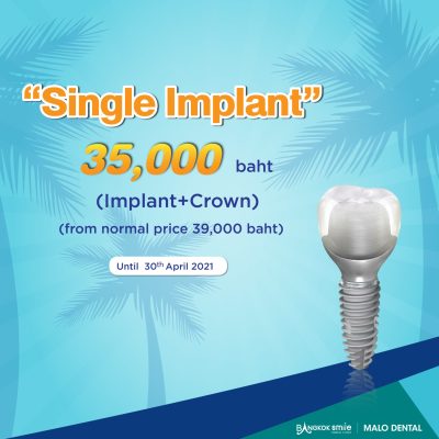 promotion dental implants promotion dental implants
